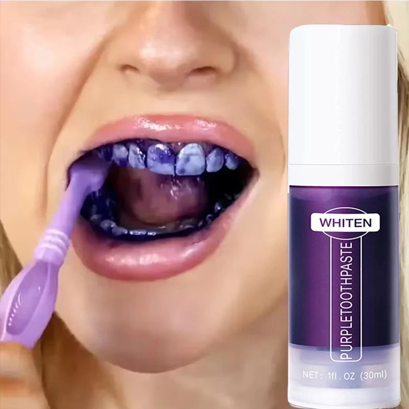 5D Teeth Whitening Stick – Whitening Toothpaste Pen for Fresh Breath | 30ml