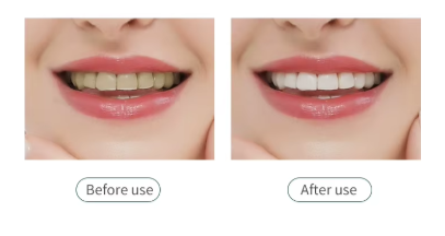 Electric Toothbrush for Adult Automatic USB Charge U-Shaped Toothbrush 360 Degrees Intelligent Rechargeable Toothbrush