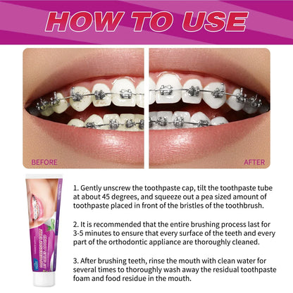 Toothpaste for Braces &amp; Aligners – Gentle Whitening Formula 50g | Removes Stains